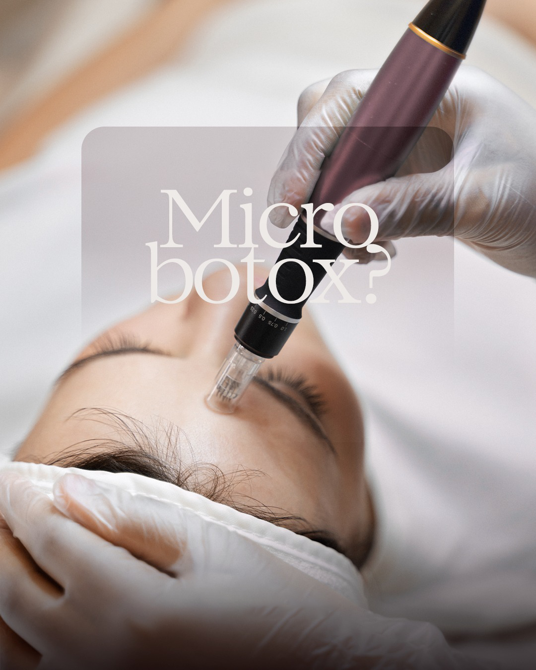 micro botox visage Aix-en-Provence
